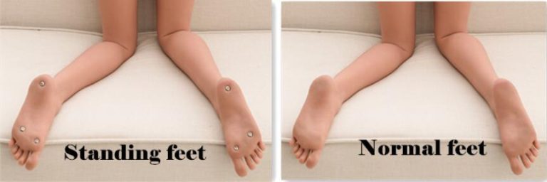 TPE Feet Option​